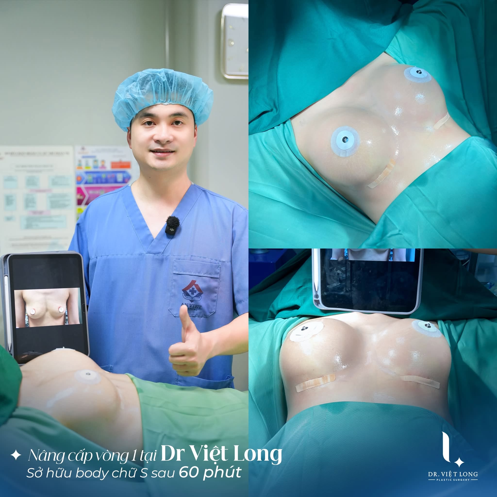 Tạo hình Vóc dáng